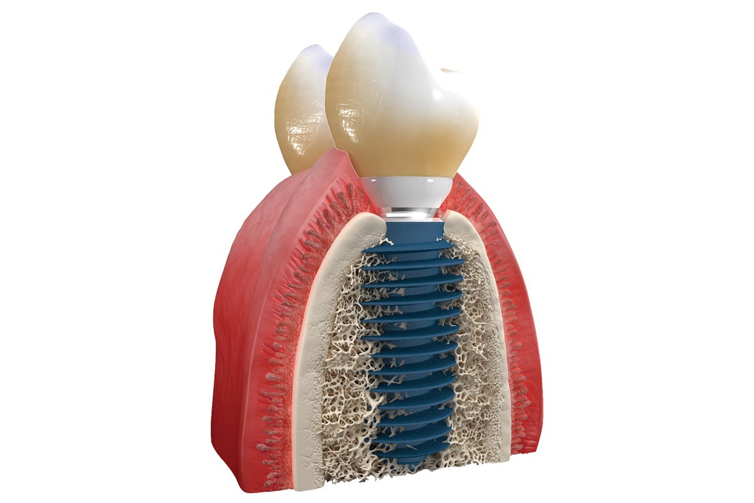 images 1702898204 65802a1c79b05