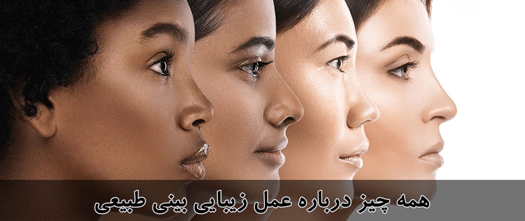 انواع جراحی بینی 3 natural rhinoplasty